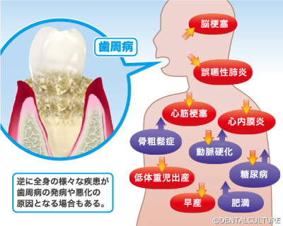 全身疾患等の関係